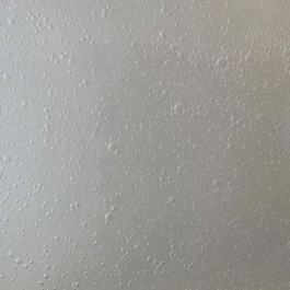 Bildausschnitt aus der Videoarbeit Glow Body Glow. Gezeigt wird eine cremeweiße Fläche, die mit lauter kleinen Bläschen übersät ist, als wären die prickelnden Bläschen eines Sektglases plötzlich an einer milchweißen Wand erstarrt. Der Lichteinfall kommt von links, das ist daran zu erkennen, dass das Weiß nach rechts hin immer mehr ins Grau übergeht und dass jedes einzelne Bläschen links eine hellbeleuchtete Sichel aufweist. 